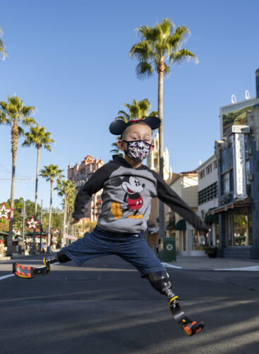 8 Year-Old Boy Tries New Prosthetic Legs for the First Time at Disney's Hollywood Studios!